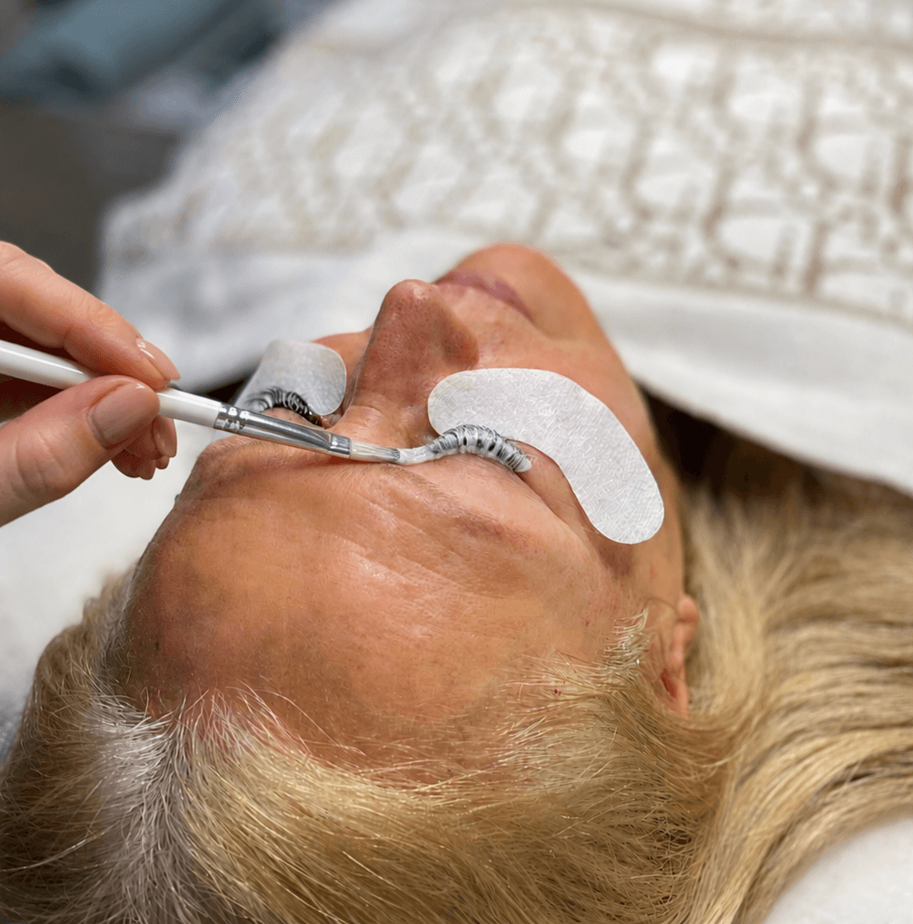 full botox — IMG_20260626_041129